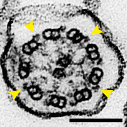 TEM of tracheal cilia cross-section from wild-type mouse with yellow arrows indicating outer dynein arms that are not visible in mice without Pierce1 or Pierce2