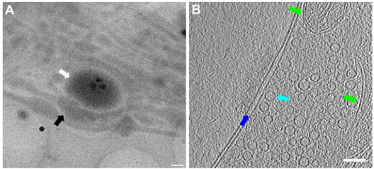 Tomogram of neurons grown on an EM grid that demonstrates functional synapses