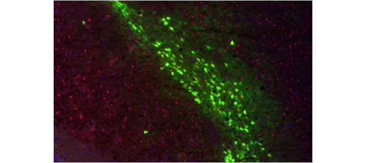 Microscopy image showing ZF activity in dopamine neurons in a mouse brain